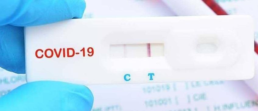 PROHIBICIÓN DE VENTA AL PÚBLICO DE TEST COVID-19 EN FARMACIAS DE LA PROVINCIA DE CÓRDOBA