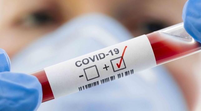 Nuevo récord de casos: 29.472 personas fueron diagnosticadas con coronavirus en el país