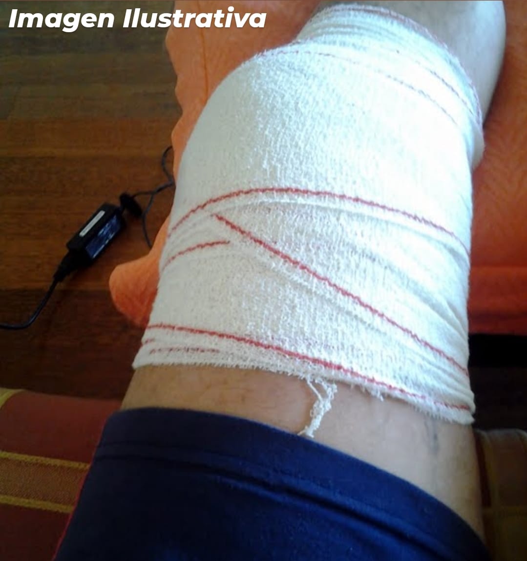 VERSIONES CRUZADAS: ABOGADO DEL PACIENTE DICE QUE SE EQUIVOCARON DE PIERNA AL OPERAR Y EL MÉDICO SOSTENDRÍA QUE NO ES VERDAD