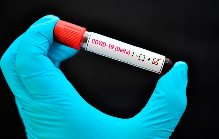 CORONAVIRUS: Hay 17 casos de la variante Delta en Córdoba y, por ahora, descartan circulación comunitaria