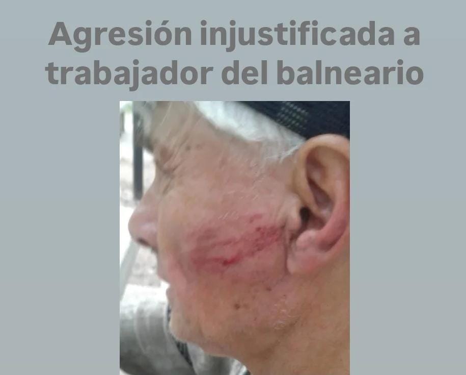Agresión injustificada a trabajador del balneario