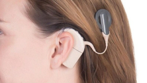 MYRIAM SANTO: EL IMPLANTE COCLEAR MARCA UN ANTES Y UN DESPUÉS EN LA OTOLOGÍA Y LA AUDIOLOGÍA MUNDIAL