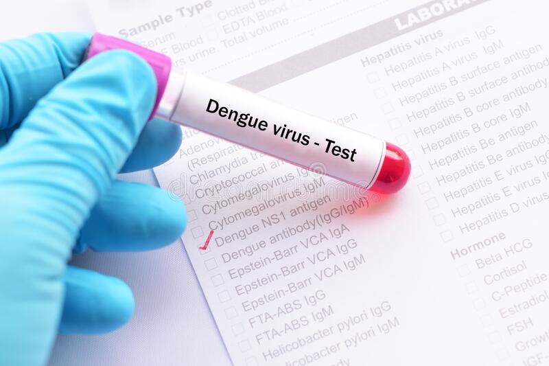 SE ESTÁN ESPERANDO LOS RESULTADOS DEL TEST REALIZADO AL POSIBLE PORTADOR DE DENGUE