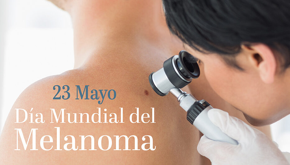Julieta Petruzzi: el melanoma es el tipo se cáncer de piel menos frecuente pero el más agresivo