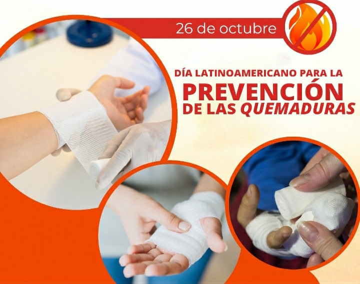 DÍA INTERNACIONAL DE LA PREVENCIÓN DE QUEMADURAS: LA IMPORTANCIA DE CUIDARSE DEL SOL