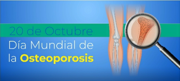 EL MÉDICO ERICK JOLICOEUR HABLÓ DE LA IMPORTANCIA DE PREVENIR LA OSTEOPOROSIS