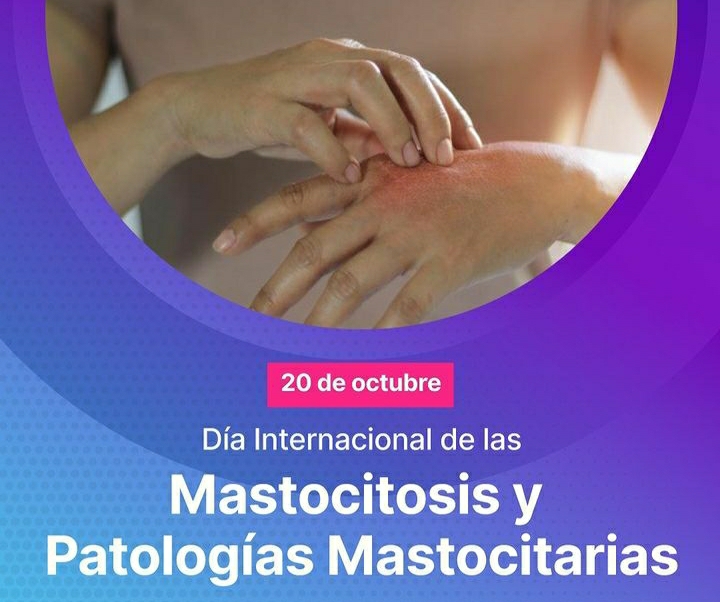 EN EL DIA INTERNACIONAL DE LAS MASTOCITOSIS HABLAMOS CON LA DERMATÓLOGA JULIETA PETRUZZI