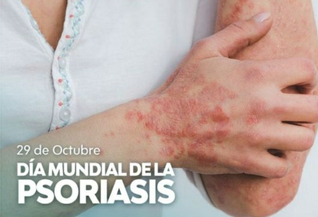 DÍA MUNDIAL DE LA PSORIASIS, UNA ENFERMEDAD QUE SIGUE SIENDO ESTIGMATIZANTE