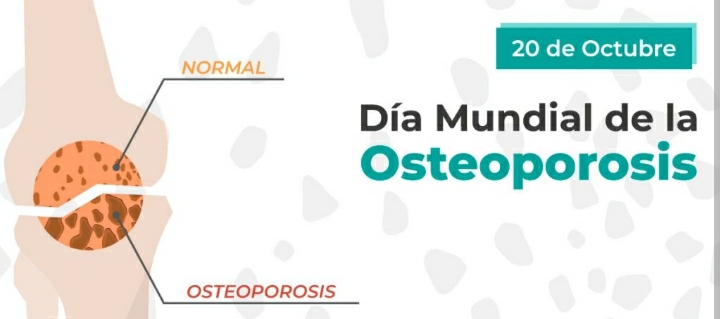 Soledad Álvarez nos brindó importante información acerca de la Osteoporosis