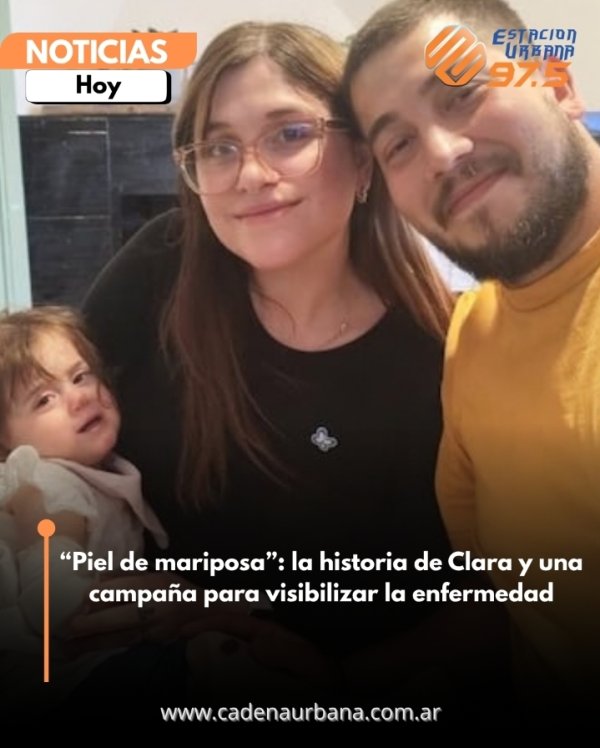 *Piel de mariposa*: la historia de Clara y una campa&ntilde;a para visibilizar la enfermedad