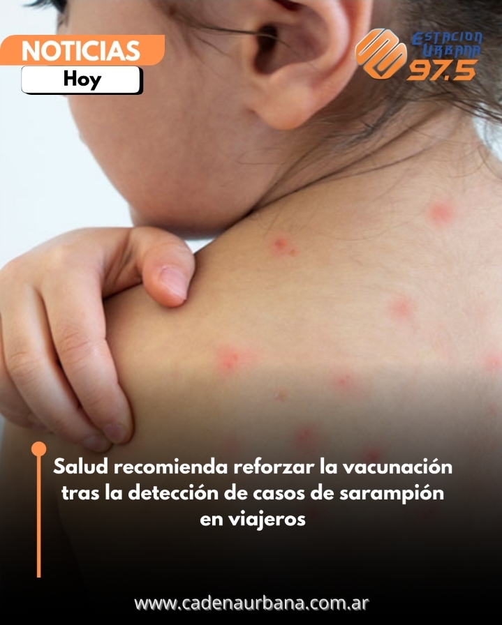 Salud recomienda reforzar la vacunación tras la detección de casos de sarampión en viajeros