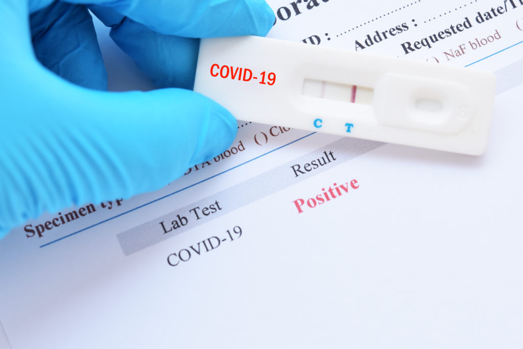 Récord histórico en el país: se registraron 42.032 nuevos contagios de coronavirus